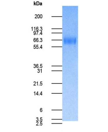 Human CD80 Recombinant Fc fusion Protein (Active) Biotin Conjugated